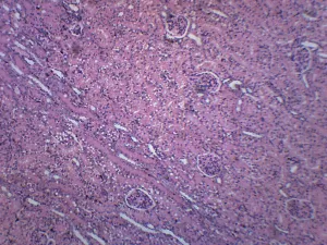 Kidney Section, Human - Prepared Microscope Slide - 75x25mm